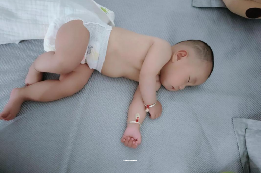 连云港宝宝头上长痱子